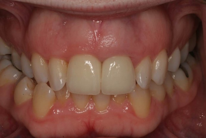 Teeth care IReland