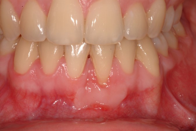 teeth care Galway