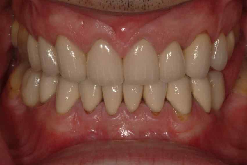 Periodontics & Implant Dentistry Specialists